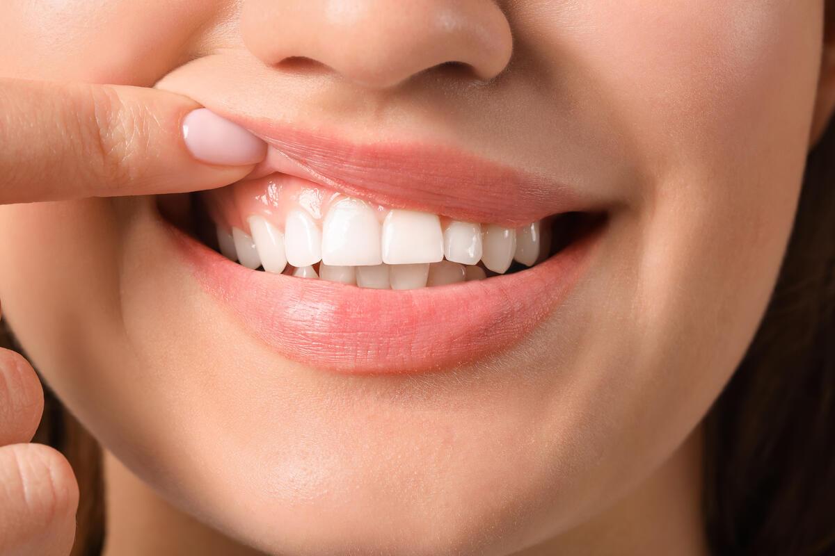 Fogínysorvadás tünetei - A jelenségek, amelyekre mindenképpen oda kell figyelnie, hogy ne veszítse el meglévő fogait – a fogínysorvadás alattomos tünete
