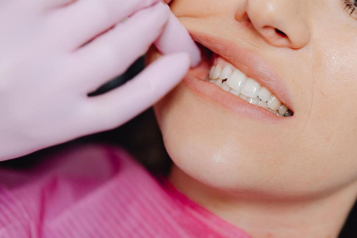 Fehér fogtömés a Móricz Dentalban – Az esztétikus és tartós megoldás fogszuvasodás ellen - Fehér fogtömés a Móricz Dentalban: esztétikus, tartós megoldás fogszuvasodásra és letört fogakra. Foglaljon időpontot a természetes és szép mosolyért!
