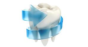 A fogzománc helyreállítása | Móricz Dental Fogászat