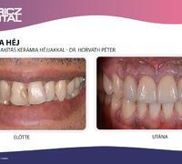 dr-horvath-peter-munkai 18. kép