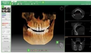 3D CT a Móricz Dentalnál
