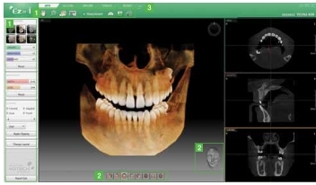 3D CT a fogászatban