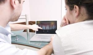 Dental fotó és konzultáció - Mosolytervezés