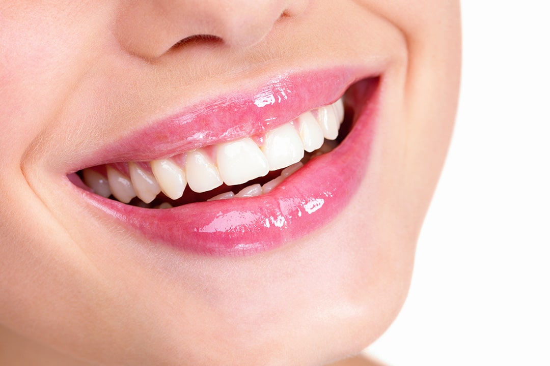 Direkt héj - Móricz Dental Fogászat