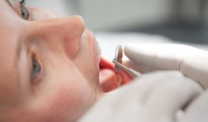 Fogorvosi vizsgálat - Móricz Dental Fogászat