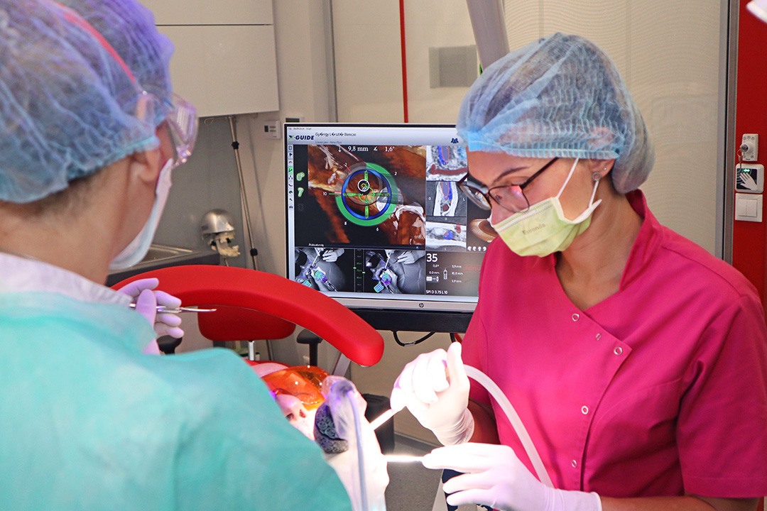 Nobel Biocare implantátumok - Móricz Dental Fogászat
