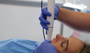 Oral scanner felvétel készítés a rendelőben