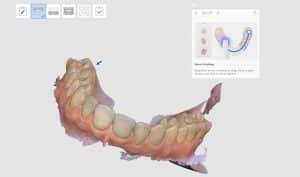Digitális oral scanner felvétel készítése - Móricz Dental Fogászat