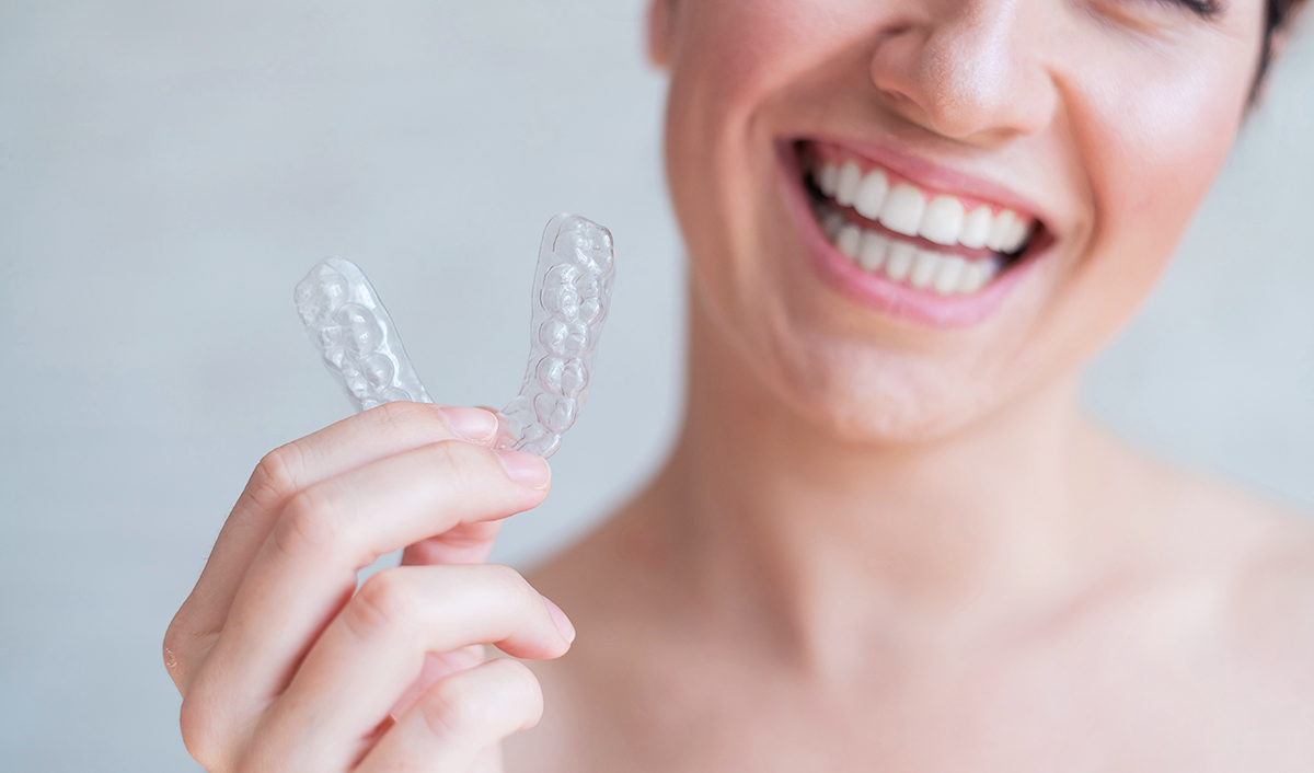 Otthoni fogfehérítés, átlátszó sín - Móricz Dental Fogászat