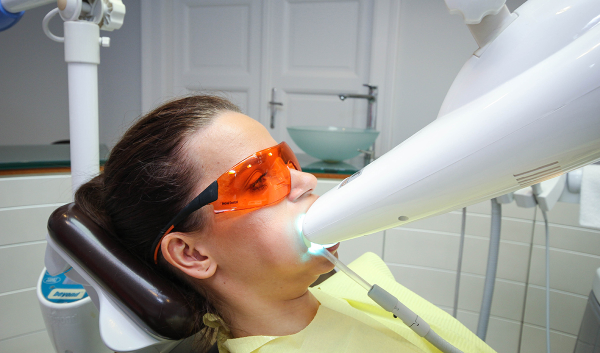 Rendelő fogfehérítés kezelés - Móricz Dental Fogászat