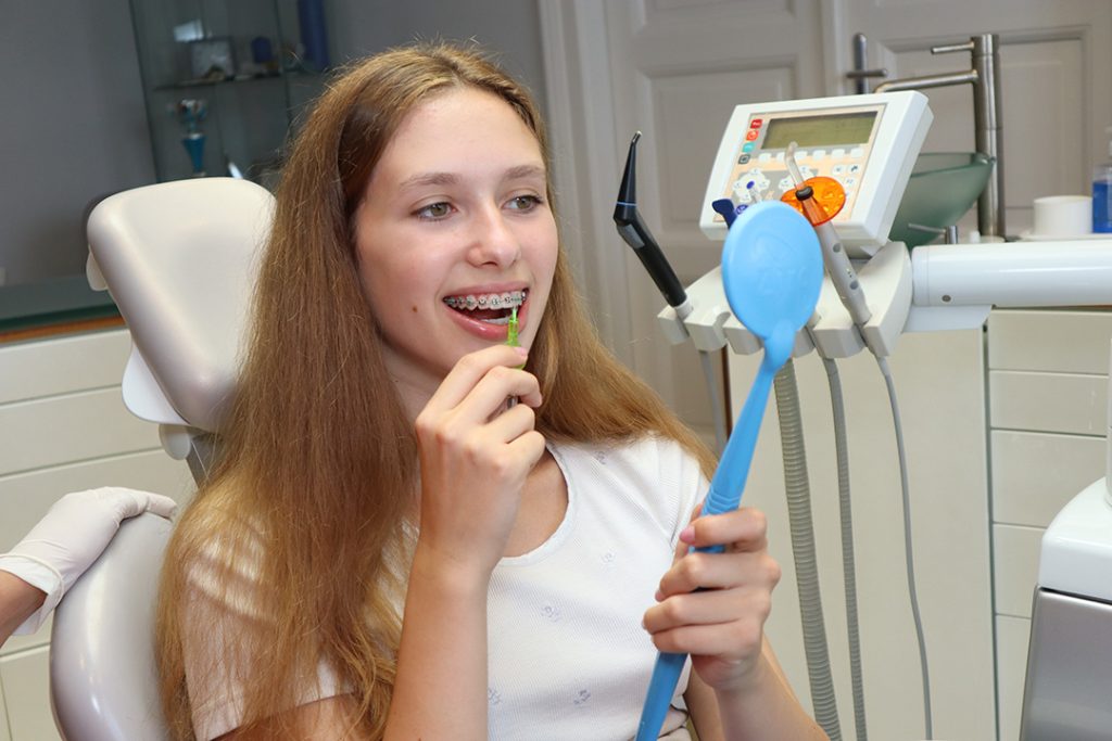 Rögzített fogszabályozó fém brackettel