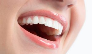 Ultrahangos fogkőleszedés előnyei - Móricz Dental Fogászat